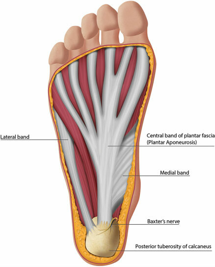 발바닥의 족저근막(Plantar Fascia)과 깊은 곳을 지나는 Baxter 신경