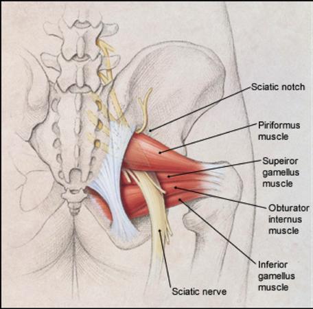 이상근(Piriformis) 아래를 지나는 좌골신경 — 이상근이 긴장하면 신경을 압박합니다.