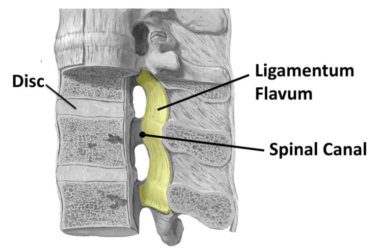 척추관·황색인대(Ligamentum Flavum)·디스크 — 노화로 인대가 두꺼워지면 신경 통로가 좁아집니다.